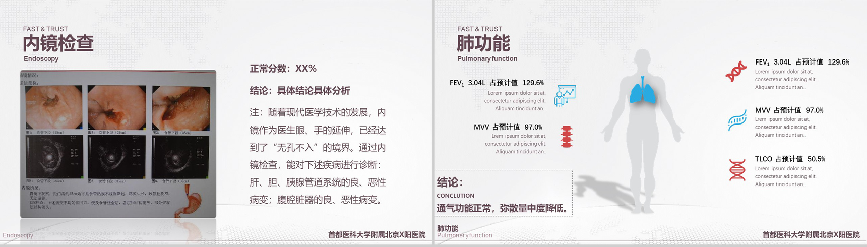 首都医科大学附属北京X医院病例汇报PPT模板-8