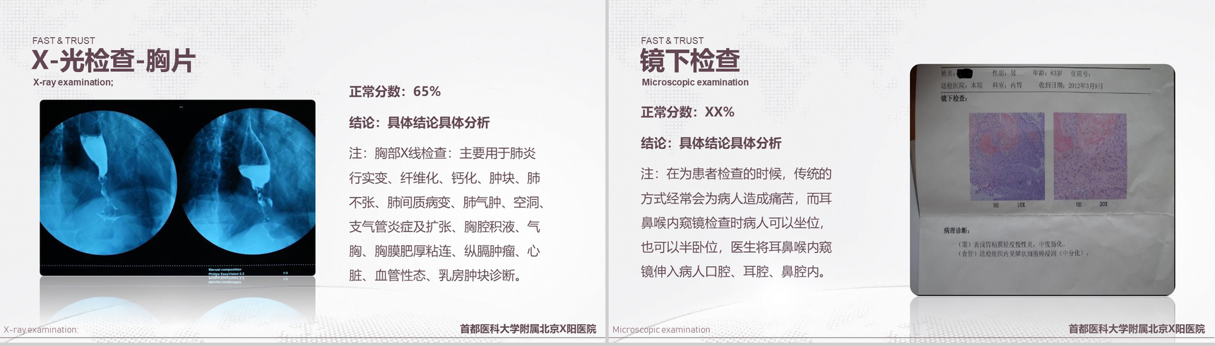 首都医科大学附属北京X医院病例汇报PPT模板-7