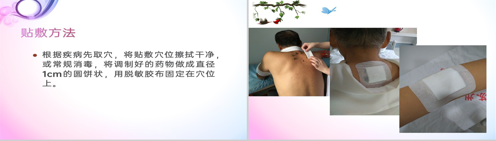 紫色简约风三伏贴技术操作规范理论基础教学PPT模板-15